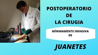 JUANETES EN LOS PIES CIRUGÍA MÍNIMA POSTOPERATORIO [upl. by Llebana]