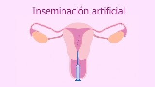 Inseminación artificial [upl. by Leigha122]