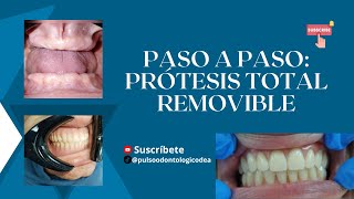 PASO A PASO para realizar un par de PRÓTESIS TOTALES REMOVIBLES Placas Dentales [upl. by Leksehc]