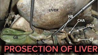 PROSECTION OF LIVER [upl. by Cence141]