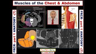 FRCR part 1 Anatomy lesson  7 Chest amp Abdomen muscle [upl. by Droffats]