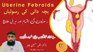 fibroids uterus home remedies  fibroids in uterus treatment  fibroids symptoms  uterine fibroids [upl. by Aicenad]