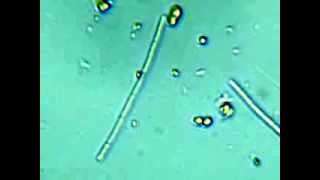 microscopio cianobacteria creciendo [upl. by Eicnarf]