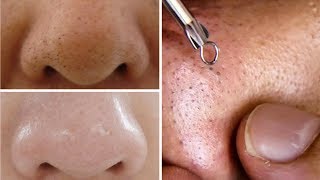 How To Do Facial Clean Up At Home Step By Step For Spotless Clear Skin Rabia Skincare [upl. by Assener839]