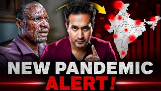 ALERT New PANDEMIC is Spreading Across The World  MPOX Virus Explained [upl. by Aloin]