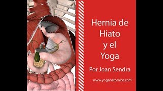 HERNIA DE HIATO Y EL YOGA [upl. by Gothart]