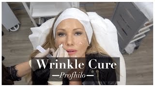 My AntiAgeing Skin Care Beauty Treatment for Younger Looking Skin PROFHILO  ADELA KING [upl. by Gentille255]