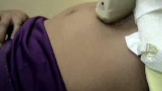 Sonogram Pregnancy 13 weeks  Embarazo 13 semanas [upl. by Eeltrebor]