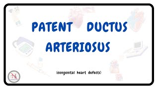 PATENT DUCTUS ARTERIOSUS  Causes  Symptoms  Pathophysiology  Treatment  The Nurses Station [upl. by Aidyl]