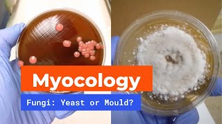 Microbiology Mycology  Yeast and Mould [upl. by Burchett]