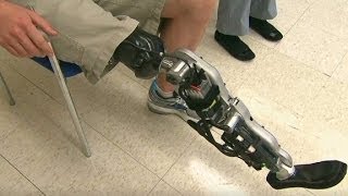 Bionic leg can read brain signals to walk [upl. by Clive]