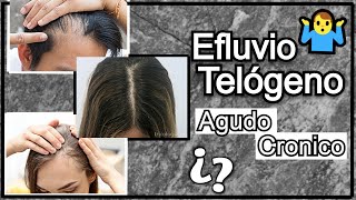 ¿Qué es el Efluvio Telógeno Agudo y Crónico ¿Qué Causa Alopecia Difusa [upl. by Cassidy]