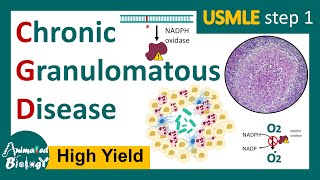 Chronic Granulomatous Disease CGD  NADPH oxidase mutation  Respiratory burst  USMLE [upl. by Beckerman474]