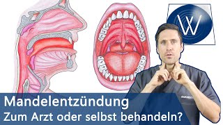 Mandelentzündung amp Halsschmerzen Schnell loswerden amp Was Sie wissen müssen wenn Sie betroffen sind [upl. by Yerfoeg817]