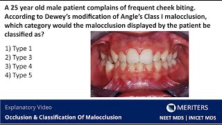 NEET MDS  INICET  Occlusion amp Classification Of Malocclusion  Explanatory Video  MERITERS [upl. by Anaud]