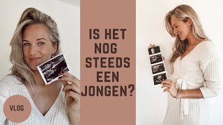 20 WEKEN ZWANGER🤰last van bekken instabiliteit 😖 [upl. by Daniala]