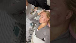 getting Morpheus 8 done 🧖🏼‍♀️ morpheus8 skincare skin morpheus8results skincaretips [upl. by Dniren99]