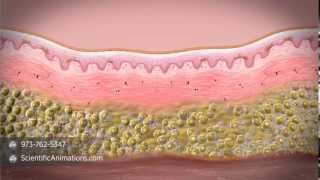 What is stem cell therapy [upl. by Marasco217]