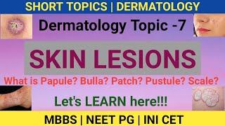 SKIN LESIONS  PAPULES PUSTULE CRUST  BULLA  Dermatology Topic 7  MBBS  NEET PG 2022 [upl. by Nwahshar]