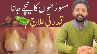 Easy Ways to GROW Receding Gums Back Naturally [upl. by Astiram]