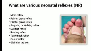 Neonatal Reflex  Plantar Grasp Reflex  Pediatrics [upl. by Olivann]