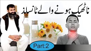 Tonsils Causes amp treatment of Tonsils Infection Homeopathic DRMMUNAWAR DAWOOD [upl. by Thorny]