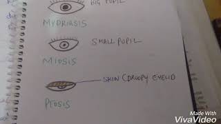 Mydriasis miosis and ptosis [upl. by Vonni]