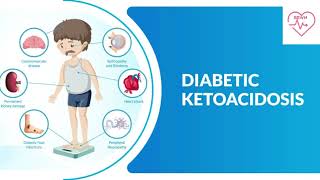 Diabetic Ketoacidosis  Endocrinology lectures  Medicine Neet pg  FMGE  Mrcp [upl. by Eelsha]