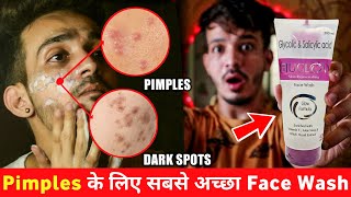 Oily Acne Prone Skin वालो के लिए Best Face Wash  Rejuglow Face Wash Honest Review 🔥 [upl. by Adnuahsor]