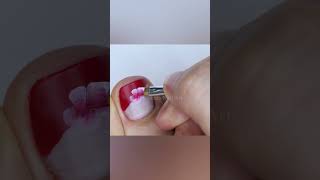 ❤️ Uñas de los Pies Decoradas con Flores Blancas y Rojas 🌹  Tutorial de Diseño Impactante shorts [upl. by Naik]