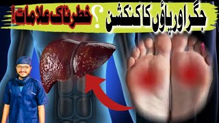 Liver disease and foot connection some alarming sign and symptomsDr H Muhammad Anees [upl. by Sallee]