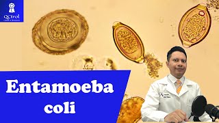 Conoce a Entamoeba coli morfología y CLAVES para su identificación Laboratorio de parasitología 🔬 [upl. by Trebbor]