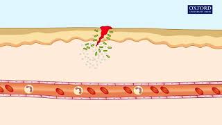 Animation 241 Inflammatory response [upl. by Gemini]