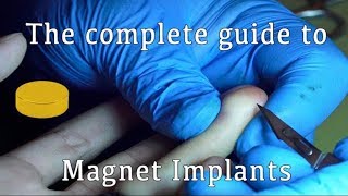 The Complete Guide to Magnet Implants [upl. by Hull]