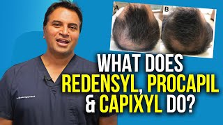 Redensyl Procapil and Capixyl For Hair Growth [upl. by Elak]