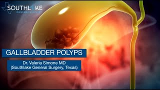 Gallbladder Polyps – Causes Symptoms amp Treatment [upl. by Nicolella]