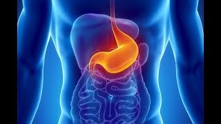 What is Dyspepsia What causes Dyspepsia Symptoms and Treatment of Indigestion [upl. by Thibault655]