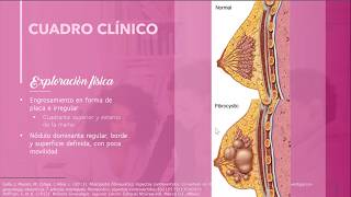 CLASE DE GINECOLOGÍA  3 DE JUNIO DE 2020  MASTOPATIA FIBROQUÍSTICA MASTITIS [upl. by Anecusa]