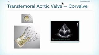 Assessment of Prostheses in Echocardiography [upl. by Farrah]