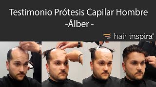 Testimonio prótesis capilar hombre Álber  Hair Inspira [upl. by Ana]