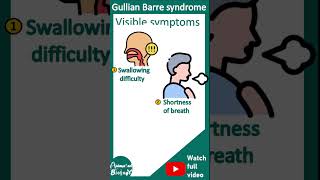 Guillain–Barré syndrome  Acute inflammatory demyelinating polyneuropathy AIDP  Pathology USMLE [upl. by Palocz660]