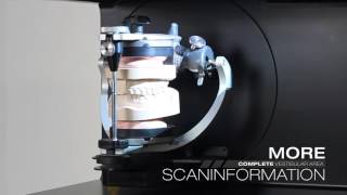 CS ULTRA Articulator Scan [upl. by Mroz]