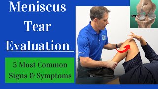 Meniscus Tear Evaluation 5 Most Common Signs and Symptoms [upl. by Rizzo]