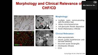 Presentazione lavoro di ricerca  Dal fegato policistico al colangiocarcinoma [upl. by Aiello]