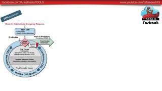 AHA 2015 guidelines for CPR Whats New  Saneesh  AnesthesiaTOOLS [upl. by Tarsuss884]