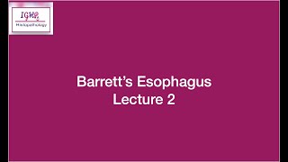 Lecture 2 Barretts Oesophagus [upl. by Akehsal]