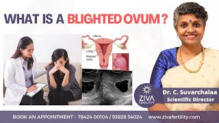 What is blighted ovum in pregnancy  Female infertility problems  Dr C Suvarchalaa  ZIVA [upl. by Layton505]