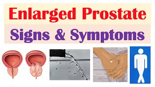 Enlarged Prostate Signs amp Symptoms amp Why They Occur [upl. by Aillimac735]