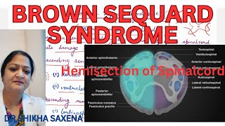 Brown Sequard Syndrome Hemisection of Spinal cord [upl. by Hendel558]