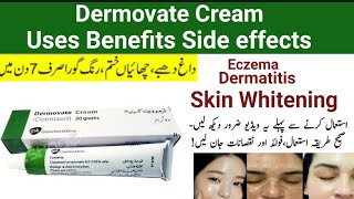 Dermovate Cream Uses in Urdu hindi l Dermovate cream for skin whitening [upl. by Nenad195]